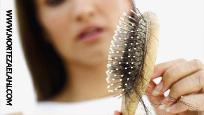 درمان ریزش مو,تقویت موهای نازک,جلوگیری از ریزش مو,جلوگیری از ریزش مو ارثی,درمان ریزش مو مردان,